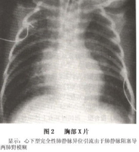 胸腔.0