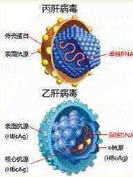 丙型病毒性肝炎