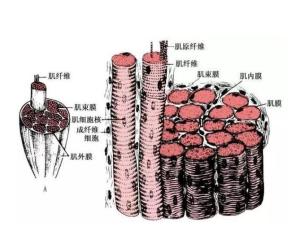 横纹肌溶解综合征