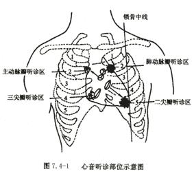 奔马律心音